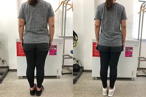 ビフォーアフターback