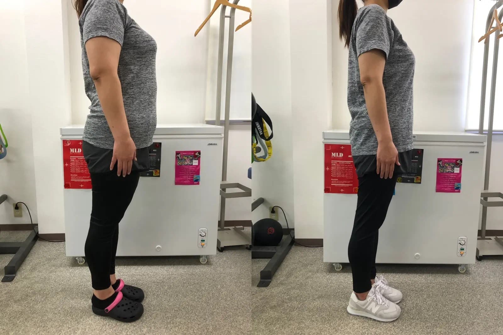 ビフォーアフターside