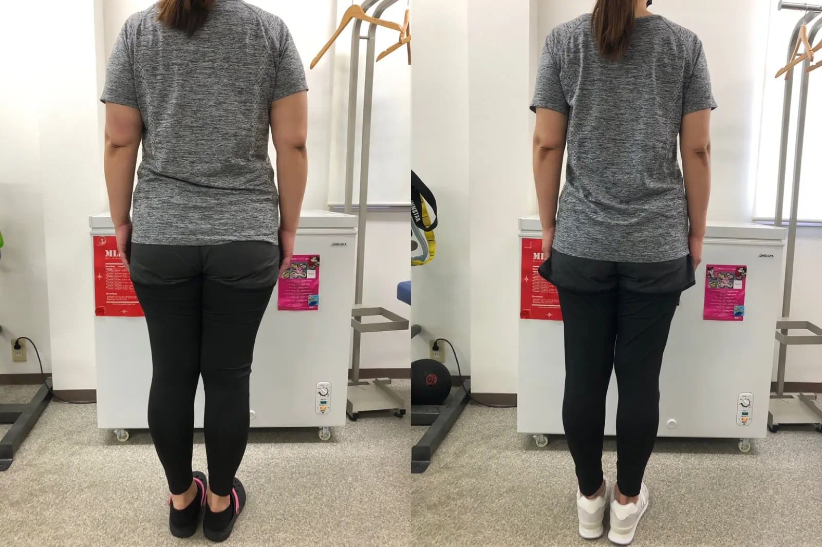 ビフォーアフターback